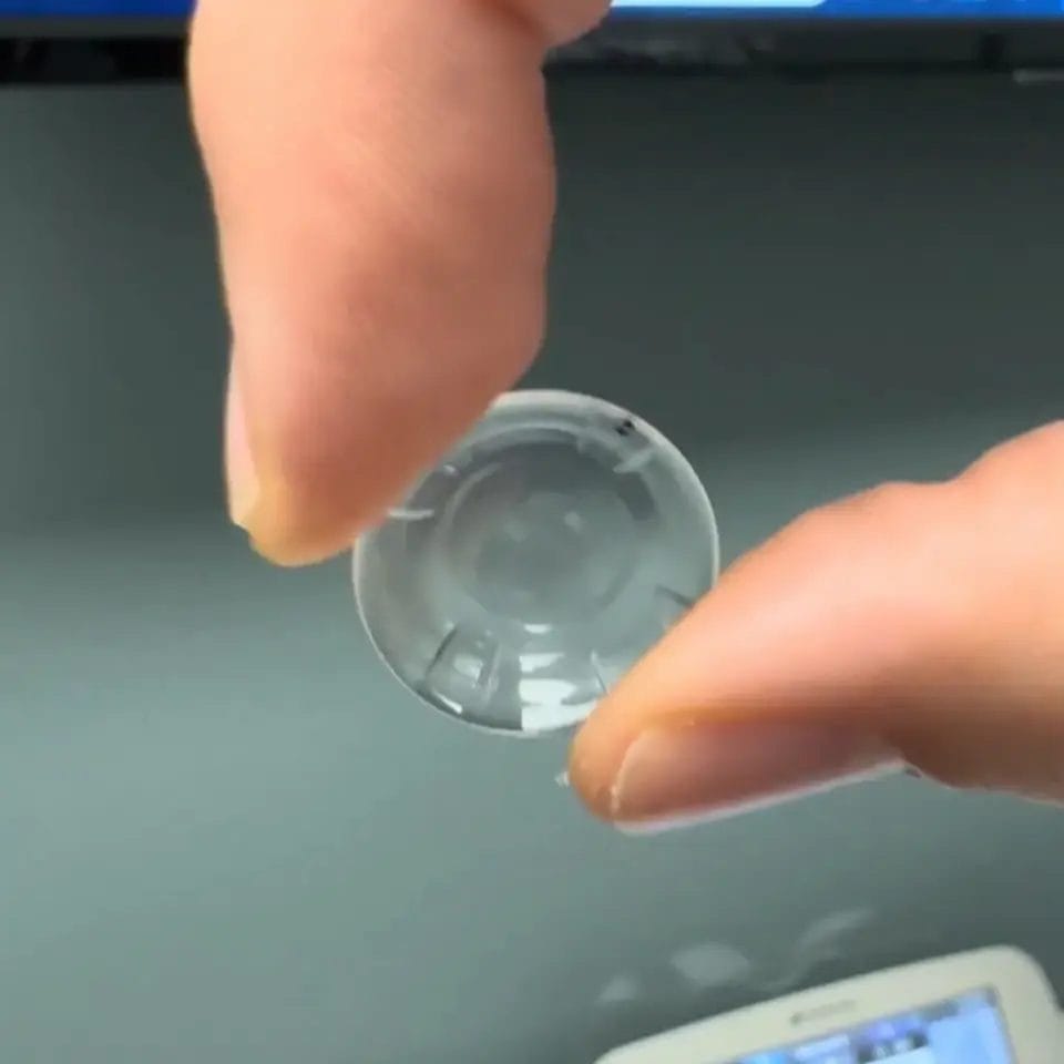 巩膜镜片是否值得选择