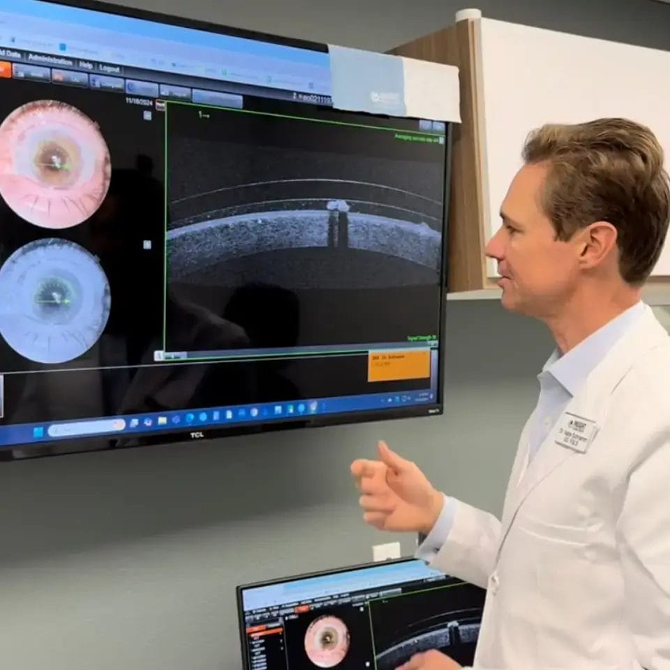 Who Benefits from Scleral Lenses