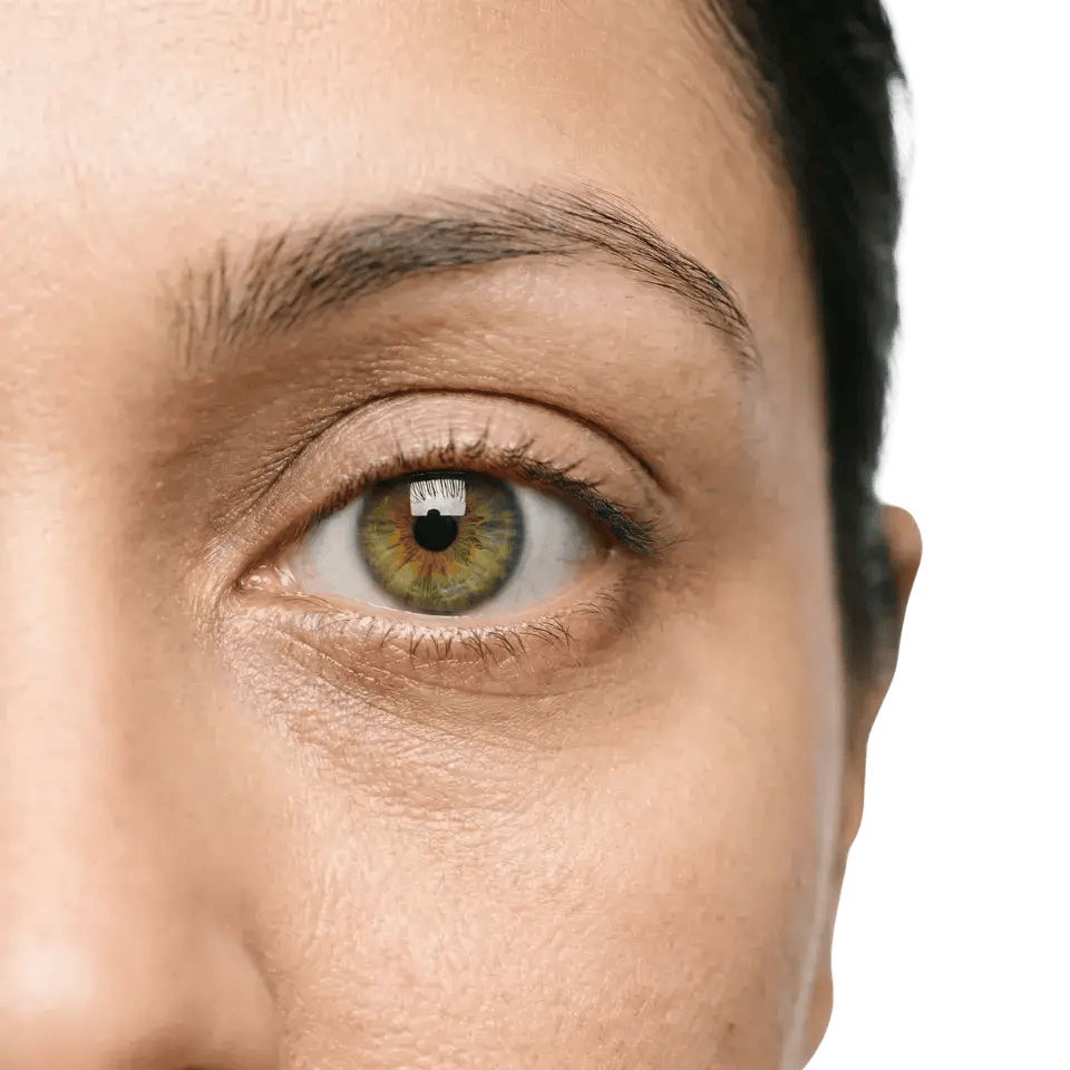 What Is Dry Eye?