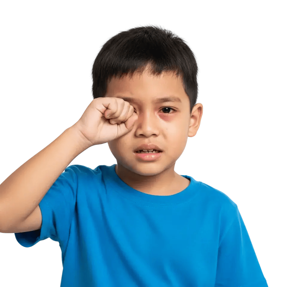 What Causes a Blocked Tear Duct in Infants